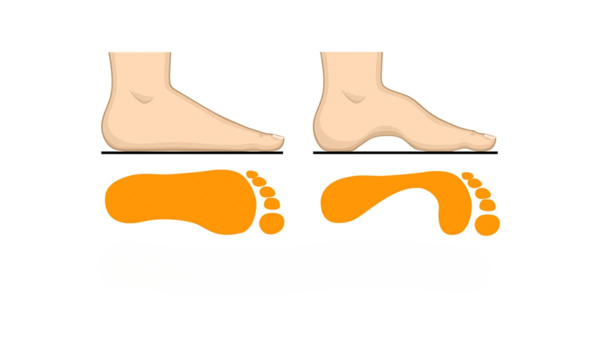 מבחן אישיות