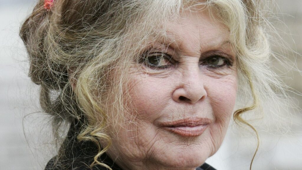 בריג'יט בארדו נמצאת ב"מצב מדאיג" לאחר שהות של 3 שבועות בבית החולים