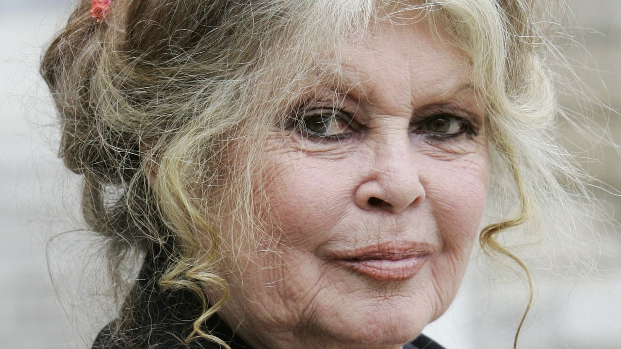 בריג'יט בארדו נמצאת ב"מצב מדאיג" לאחר שהות של 3 שבועות בבית החולים